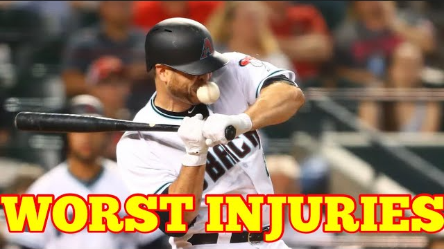  بدترین مصدومیت‌ها در MLB