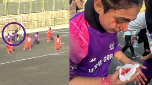 مصدومیت خونین بازیکن آوا مقابل زنان پرسپولیس