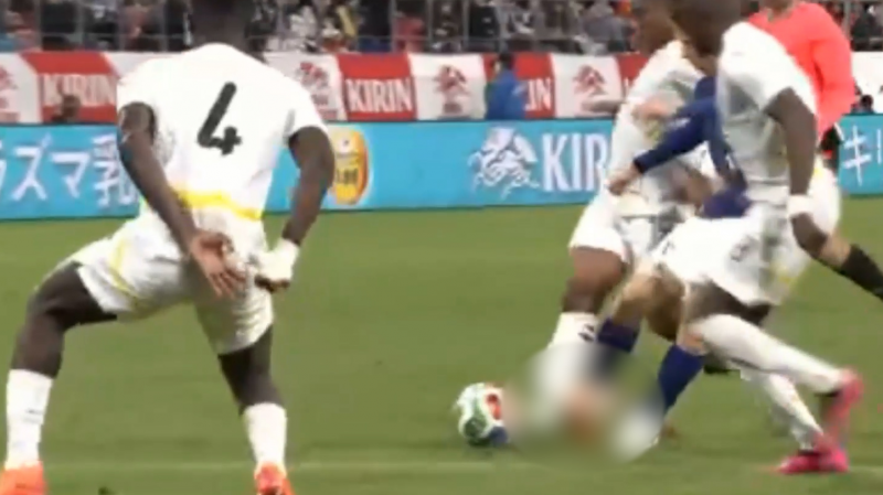 ترسناک‌ترین مصدومیت: انگار پا از جا درآمده بود!