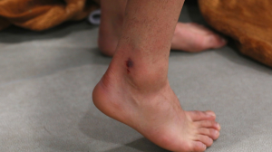 مطهری: عکس مچ پای بازیکن ما گویای همه چیز است