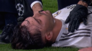 مصدومیت شدید آسنسیو از زاویه تماشاگران